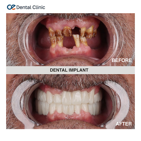 Dental Aesthetic Dental Aesthetic
