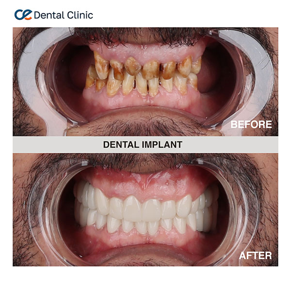 Dental Aesthetic Dental Aesthetic