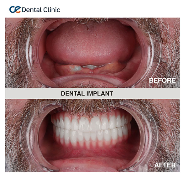 Dental Aesthetic Dental Aesthetic