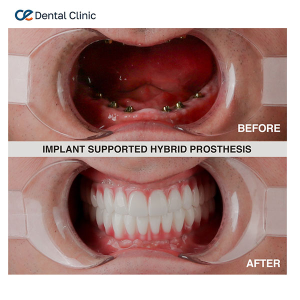 Dental Aesthetic Dental Aesthetic