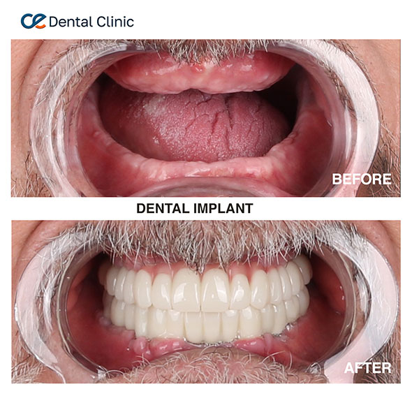 Dental Aesthetic Dental Aesthetic